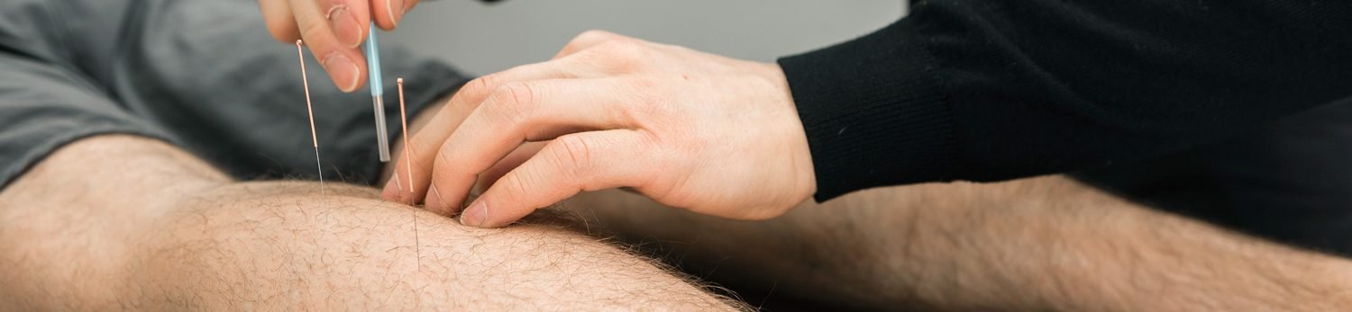 Fisioterapia Invasiva